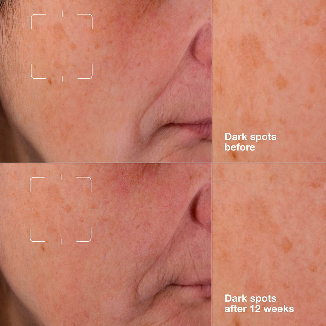 Clinique Even Better Clinical™ Dark Spot Clearing Serum 75ml